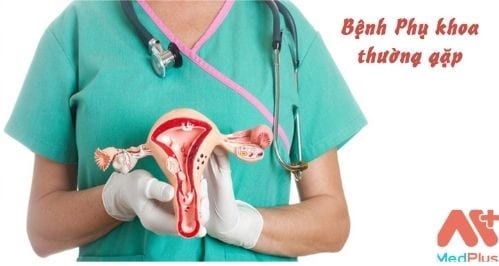 Bệnh phụ khoa là một tập hợp các bệnh lý ảnh hưởng đến cơ quan sinh sản của nữ giới