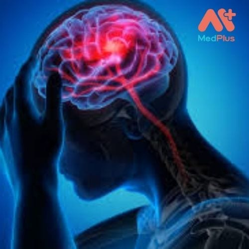Động kinh là mộBệnh động kinh là một bệnh lý xảy ra do hệ thống thần kinh trung ương bị rối loạn.t bệnh lý xảy ra do hệ thống thần kinh trung ương bị rối loạn.