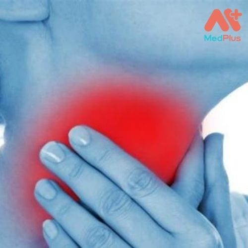 Nguyên nhân gây ra bệnh Ung thư vòm họng bạn cần biết 129 Tác nhân dẫn đến ung thư vòm họng