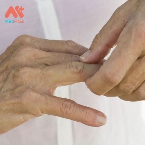 Viêm khớp ngón tay có thể khá khó chịu, gây ra các triệu chứng như đau khớp, sưng