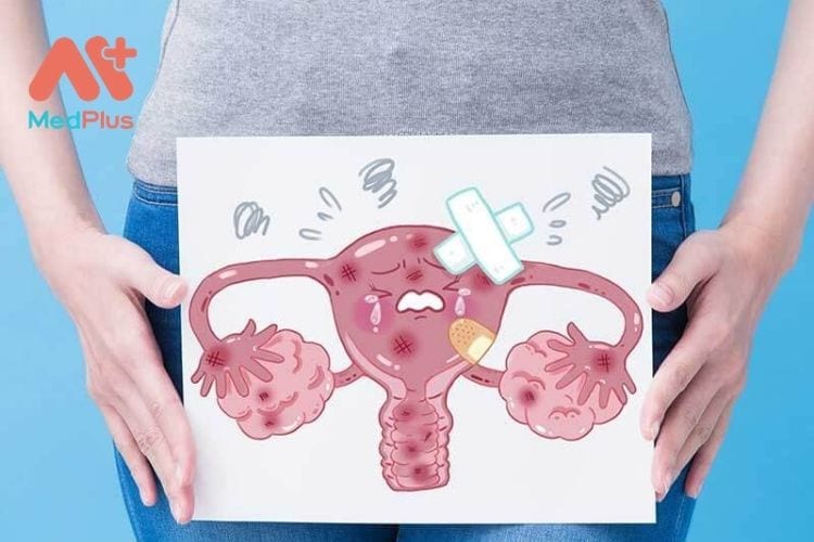 TOP 10+ Dung dịch vệ sinh phụ nữ cho người bị nấm ngứa vùng kín 133 Nguyên nhân dẫn đến nấm ngứa vùng kín