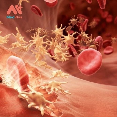 Rối loạn máu có thể ảnh hưởng đến các thành phần tế bào hoặc huyết tương của máu, tủy xương hoặc mô bạch huyết