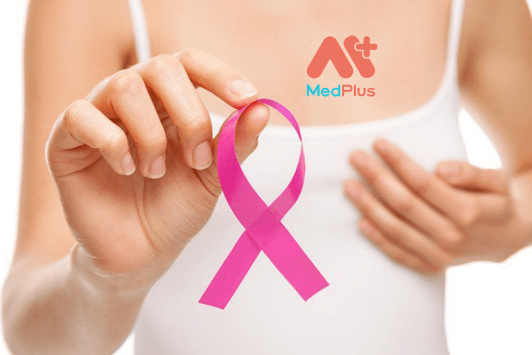 4 Phương Pháp Điều Trị Ung Thư Vú Dương Tính Với HER2