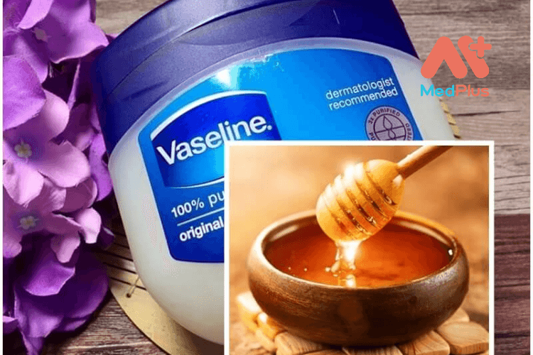 mat ong vaseline 1 - Medplus