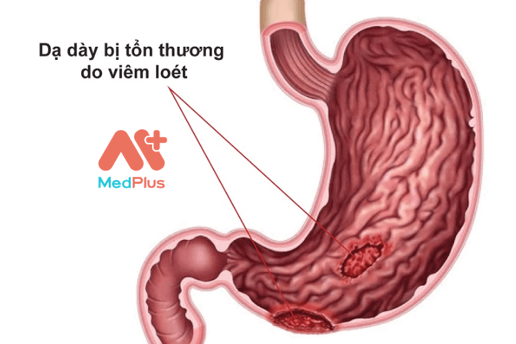 viem loet da day 2 1 - Medplus