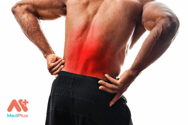 Xigduo XR có thể dẫn đến tình trạng đau lưng