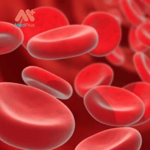Bệnh bạch cầu có thể phát triển do vấn đề sản xuất tế bào máu.