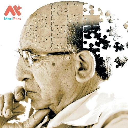 Các yếu tố nguy cơ của bệnh Alzheimer