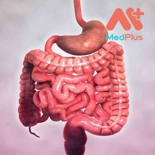 Bệnh Crohn là gì?
