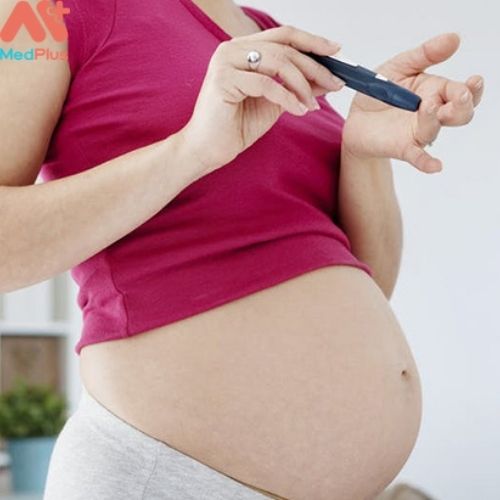 Hội chứng buồng trứng đa nang và mang thai