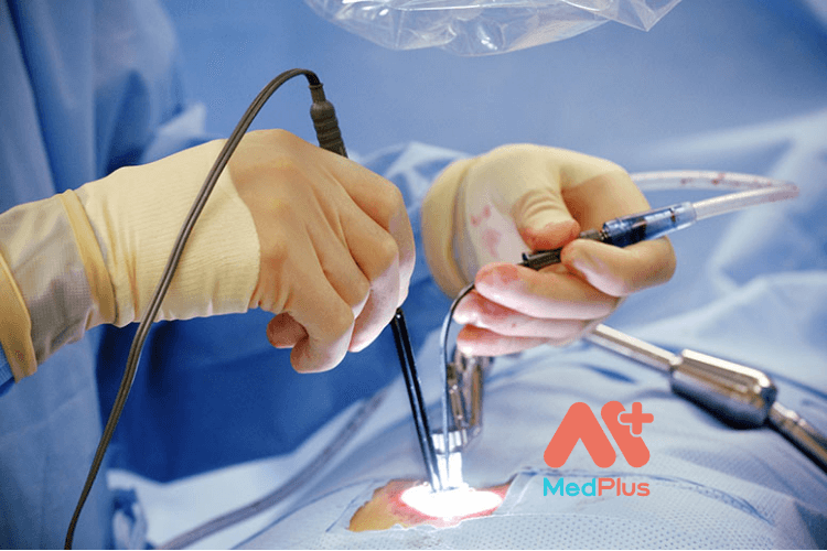 tran dich ngoai mang tim 4 1 - Medplus