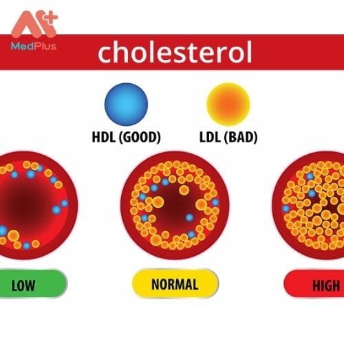 Cholesterol là gì và nó ảnh hưởng như thế nào đến sức khỏe 