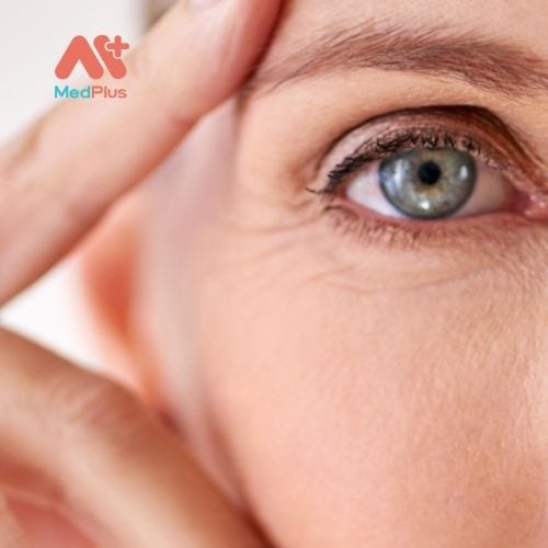 Đục thủy tinh thể là nguyên nhân hàng đầu gây ra mù lòa.
