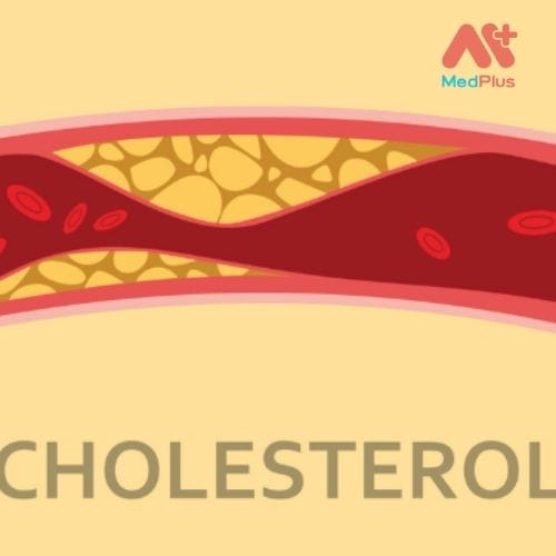 Duy trì mức cholesterol khỏe mạnh giúp ngăn ngừa bệnh tim.