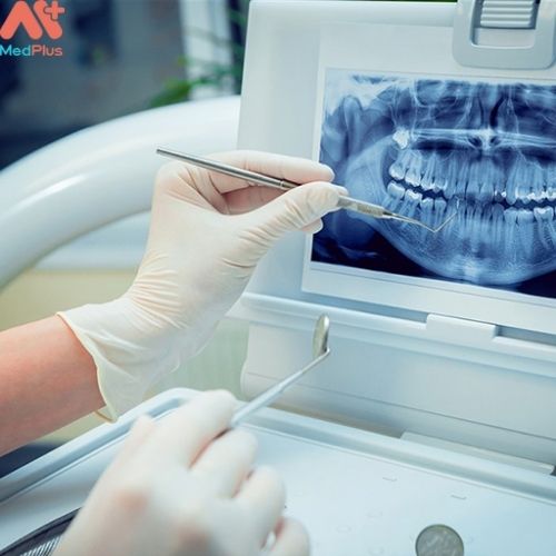 Quy trình thăm khám tại Phòng khám Răng hàm mặt Bs Phạm Hồng Phong nhanh gọn và không mất nhiều thời gian
