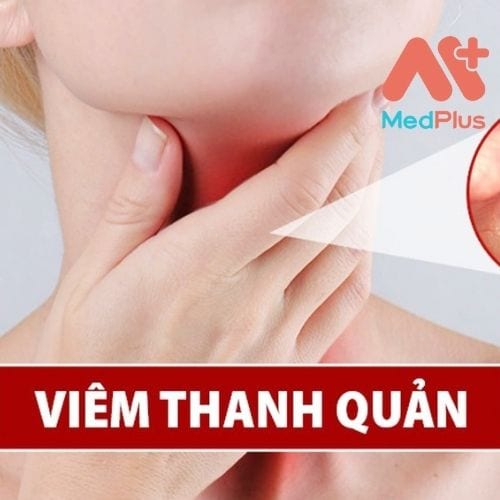 Bệnh viêm thanh quản