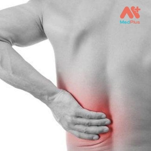 Viêm khớp thắt lưng là kết quả của các loại viêm khớp cụ thể