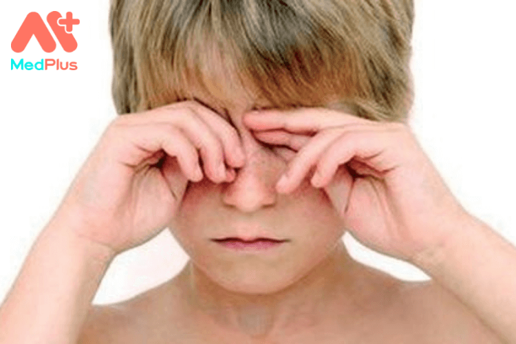Điều trị nhược thị ở trẻ em hiệu quả
