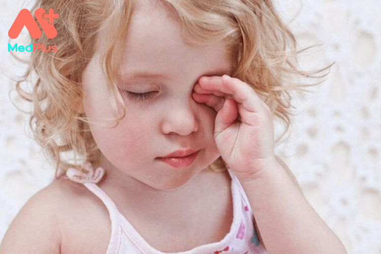 Điều trị nhược thị ở trẻ em hiệu quả