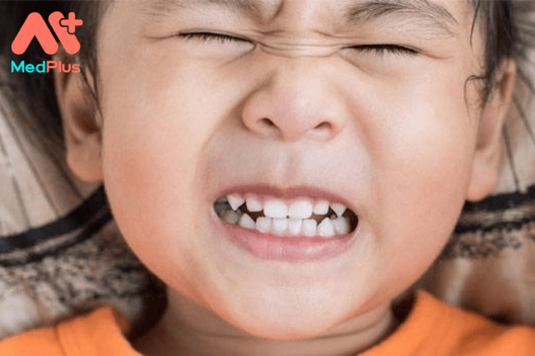 Làm gì để cải thiện tình trạng trẻ nghiến răng?