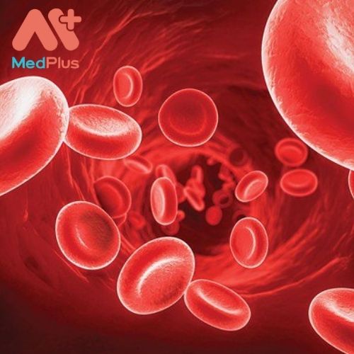 Bệnh hạ kali máu