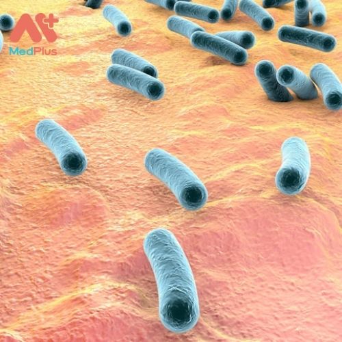 Bệnh lao do một loại vi khuẩn gọi là Mycobacterium tuberculosis gây ra khi vi khuẩn này lây lan từ người này sang người khác