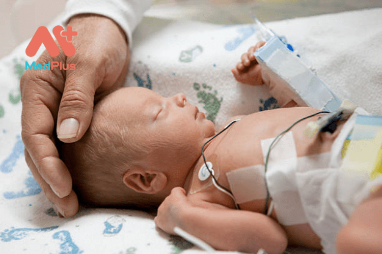 Cách chăm sóc một em bé sinh non
