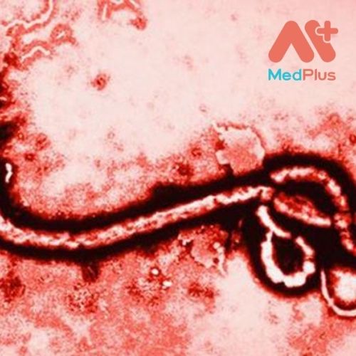 Virus Ebola là một căn bệnh xuất huyết do vi rút gây ra có tỷ lệ tử vong cao.