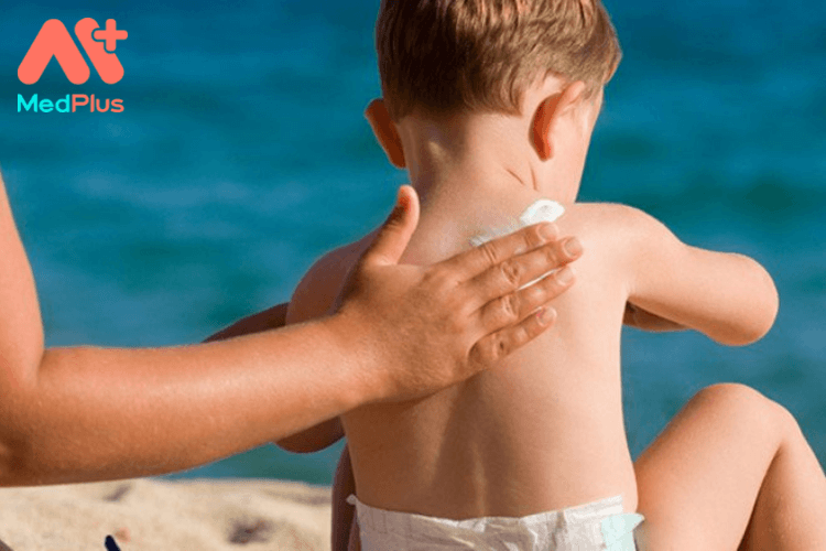 Có nên dùng kem chống nắng cho trẻ không?