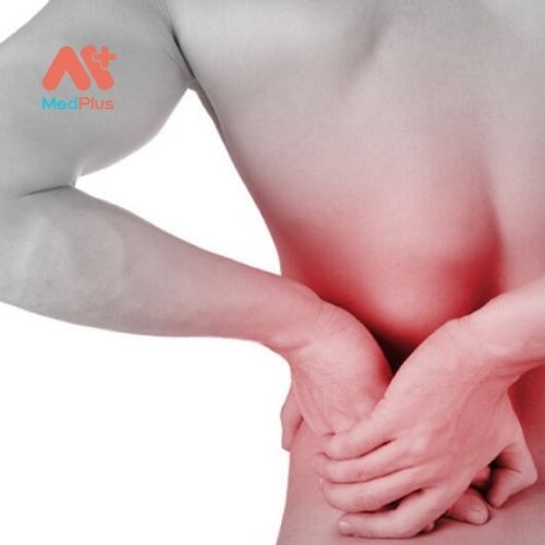 Giãn dây chằng lưng gây ra hạn chế vận động kèm theo những cơn đau kéo dài