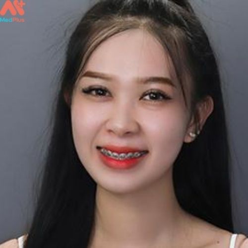 Nha khoa Tâm Đức Smile có nhiều dịch vụ khám chất lượng