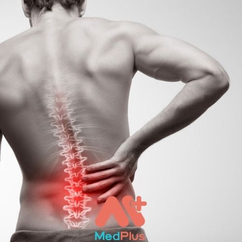 4 ĐIỀU CẦN BIẾT VỀ LOÃNG XƯƠNG LÀ GÌ? 130 Loãng xương là gì?