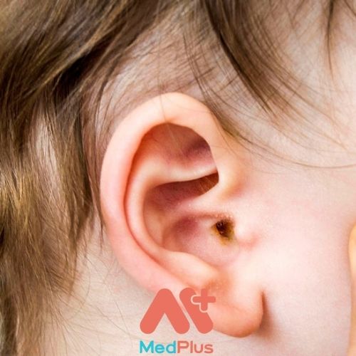 Các bệnh về tai