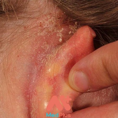 Các bệnh về tai