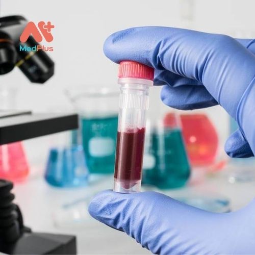 Xét nghiệm tìm máu ẩn trong phân có nhiều loại