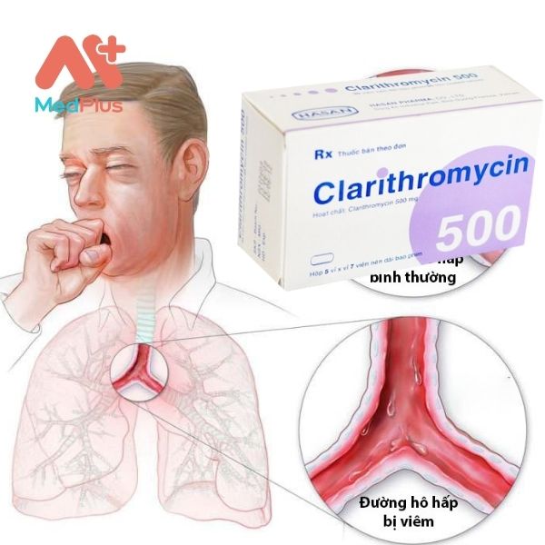 Thuốc kháng sinh Clarithromycin 500mg chống viêm đường hô hấp