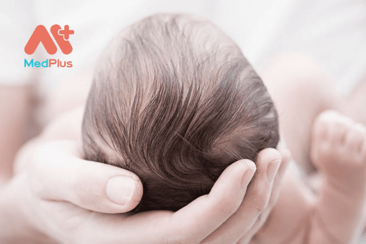Những kiến thức về hình dạng đầu của em bé