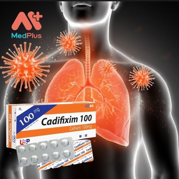 Thuốc kháng sinh Cadifixim 100mg điều trị nhiễm trùng, nhiễm khuẩn đường hô hấp