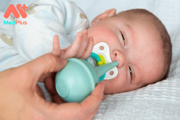 4 điều cần lưu ý khi hút mũi cho trẻ sơ sinh