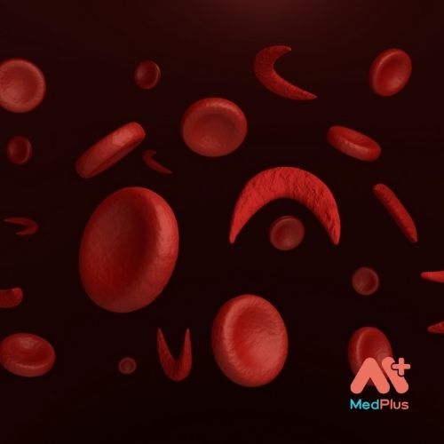 Bệnh thiếu máu hồng cầu hình liềm
