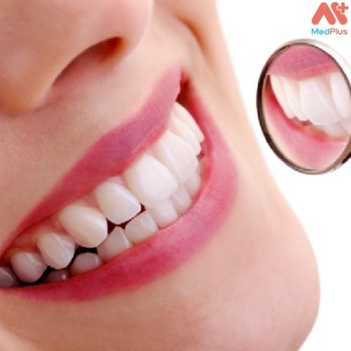 Phục hình răng sứ thẩm mỹ là một trong những dịch vụ được ưa chuộng tại Nha khoa Thẩm mỹ Asia 
