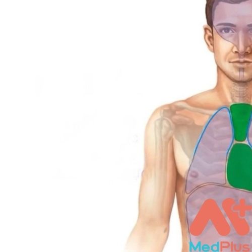 HỘI CHỨNG TRUNG THẤT CÓ TÌNH TRẠNG NHƯ THẾ NÀO? 130 Hội chứng trung thất