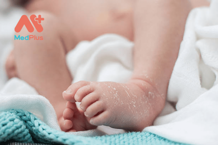 Chăm sóc làn da khô ở trẻ sơ sinh