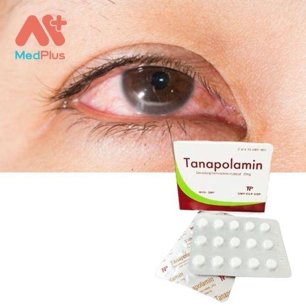 Thuốc Tanapolamin điều trị viêm kết mạc, viêm mũi, dị ứng