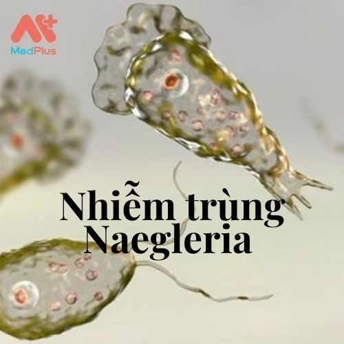 Nhiễm trùng Naegleria