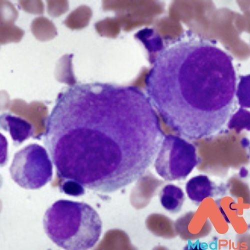 Rối loạn sinh tủy