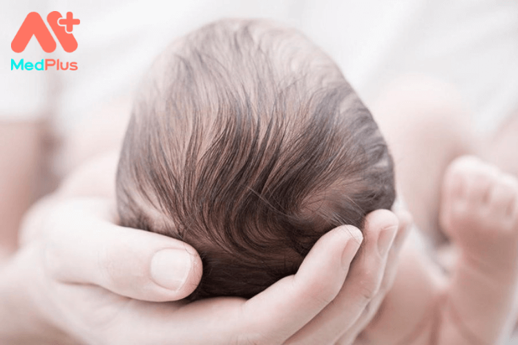 Rụng tóc vành khăn ở trẻ sơ sinh phải làm sao?