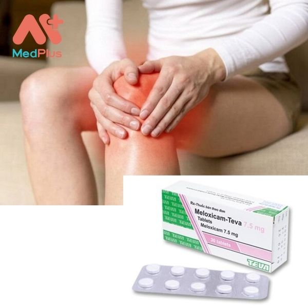 Thuốc Meloxicam-Teva 7.5 mg điều trị các cơn đau xương khớp