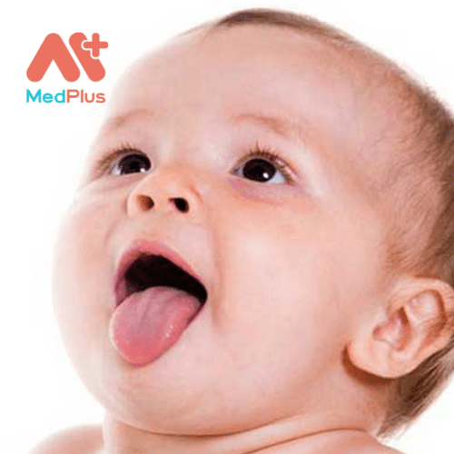 Benh nam mieng o tre so sinh la gi - Medplus