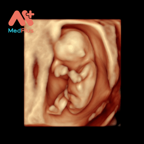 Sieu am thai 3D co y nghia quan trong - Medplus